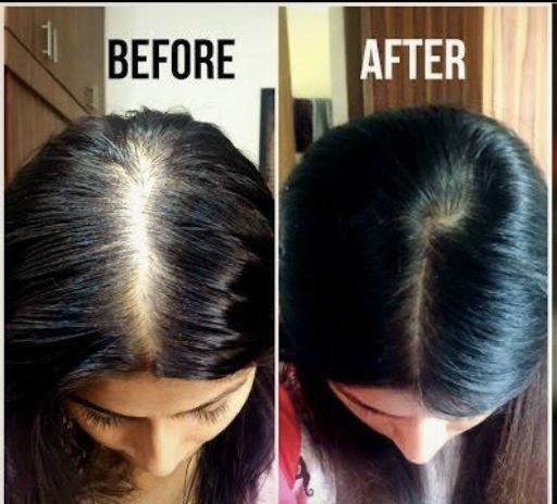 PureShanti Hair Oil For Hair Growth & Care